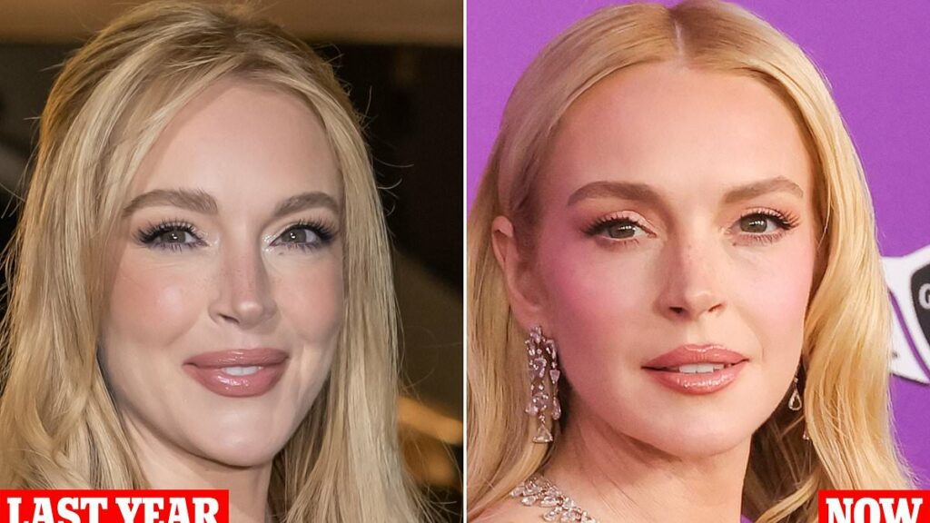 Plastic surgeons reveal the work Lindsay Lohan is rumored to have had