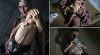 Viral images of starving Gaza boy don't tell the whole story because he suffers from genetic disorders, critics say