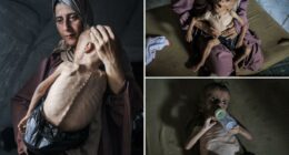 Viral images of starving Gaza boy don't tell the whole story because he suffers from genetic disorders, critics say