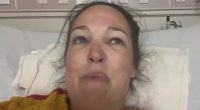 Shark attack victim in hospital bed.