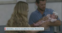 'Forever grateful': rare procedure performed at Memorial Health on July 1