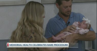'Forever grateful': rare procedure performed at Memorial Health on July 1