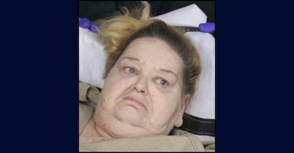 500-pound woman attacks EMTs taking her out of home: Cops