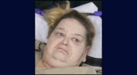 500-pound woman attacks EMTs taking her out of home: Cops