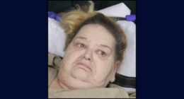 500-pound woman attacks EMTs taking her out of home: Cops