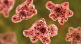 Boy, 12, dies of brain-eating amoeba after swimming in South Carolina reservoir