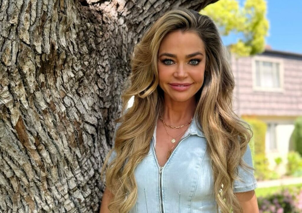 Denise Richards Sparks Facelift Rumors Amid Scars on RHOBH Alum's Face