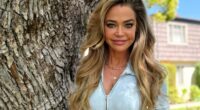 Denise Richards Sparks Facelift Rumors Amid Scars on RHOBH Alum's Face