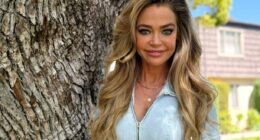 Denise Richards Sparks Facelift Rumors Amid Scars on RHOBH Alum's Face