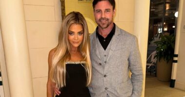 Denise Richards' estranged husband reveals how she got her black eye