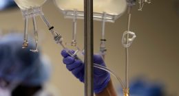 Fact check: Medicaid cuts for immigrants in Trump's 'big, beautiful bill'