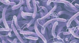 'Flesh-eating' bacteria death reported in St. Augustine. Here's what to know