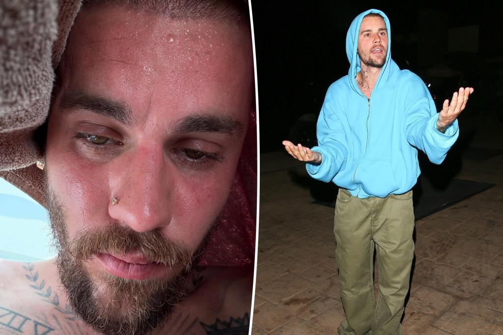 Justin Bieber shares sweaty ‘detox’ selfies as fans show support: ‘Please stay healthy and happy’