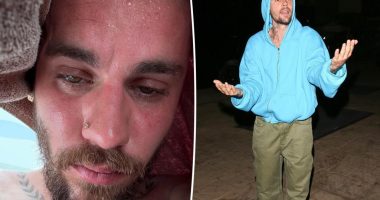 Justin Bieber shares sweaty ‘detox’ selfies as fans show support: ‘Please stay healthy and happy’