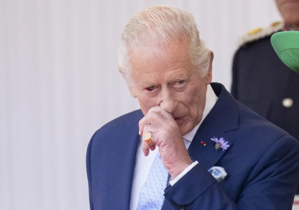 King Charles Sparks New Health Concerns After His Appearance With Bloodshot Eye During French President Emmanuel Macron Welcome
