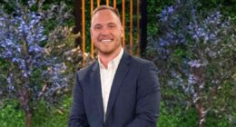 Love Is Blind’s Jimmy Presnell Reveals Cost of His Hair Transplant