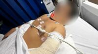 A man who almost lost his hand during a violent attack outside a Melbourne shopping centre says his life will never be the same again.Saurabh Anand has been discharged from hospital but may never be able to use his hand properly again.