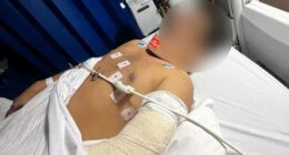 A man who almost lost his hand during a violent attack outside a Melbourne shopping centre says his life will never be the same again.Saurabh Anand has been discharged from hospital but may never be able to use his hand properly again.