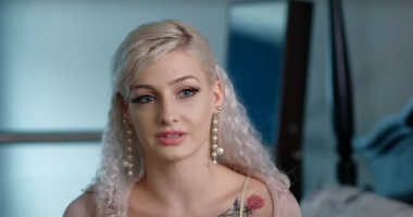 Moriah Plath Shares 'Vulnerable' Journey With Alopecia After Hair Loss
