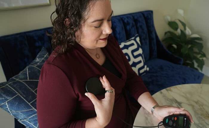 NIH cuts spotlight a hidden crisis facing patients with experimental brain implants