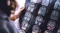 Dementia is one of the leading causes of death in Australia but a new finding could revolutionise detection and treatment.