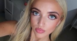 Princess Andre hits back at lip filler accusation as she shares selfie