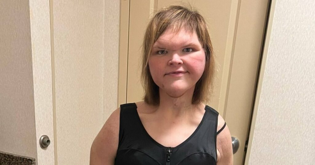 Tammy Slaton Wears Shapewear After Weight Loss, Skin Removal Surgeries