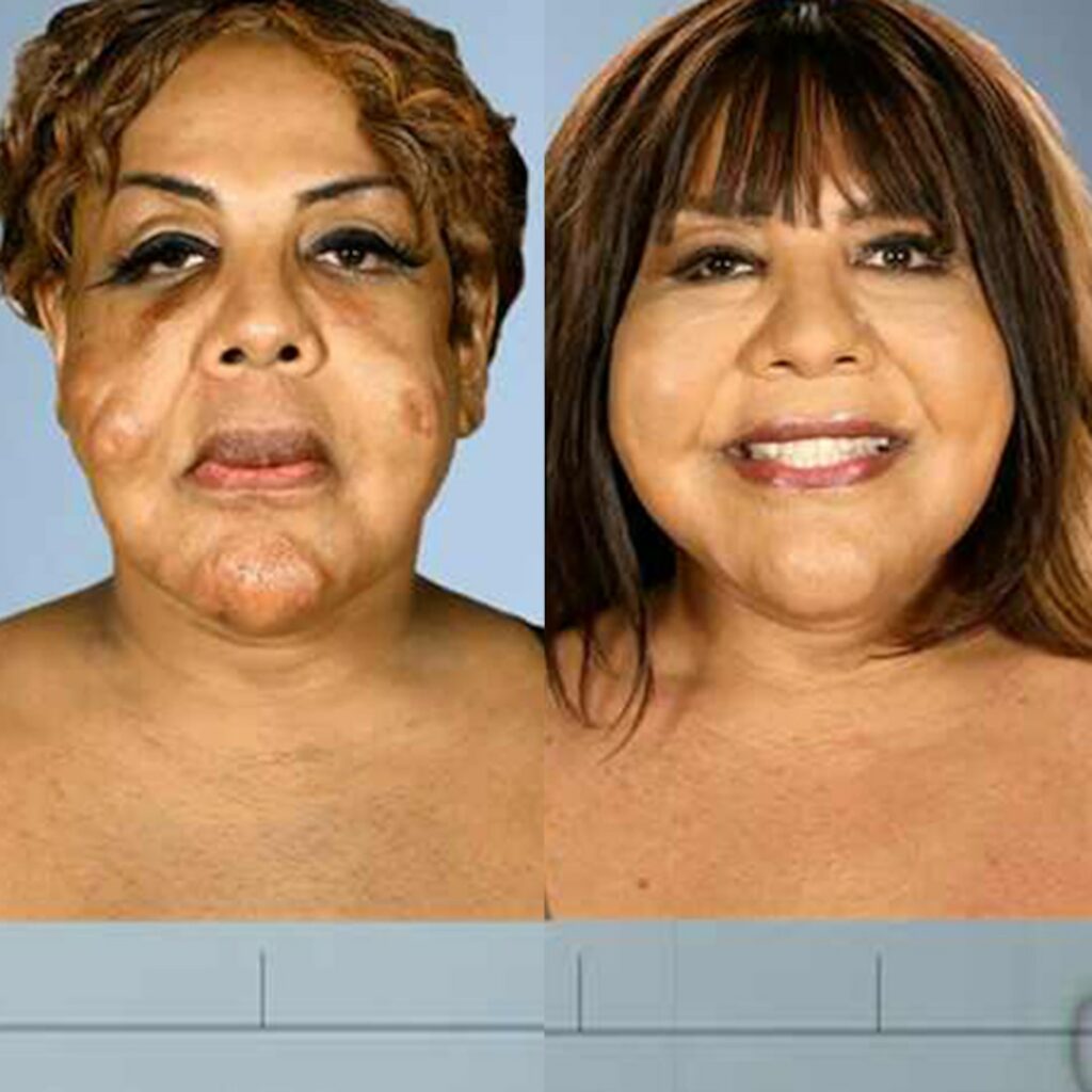 These Botched Plastic Surgery Before-and-After Pics Will Shock You