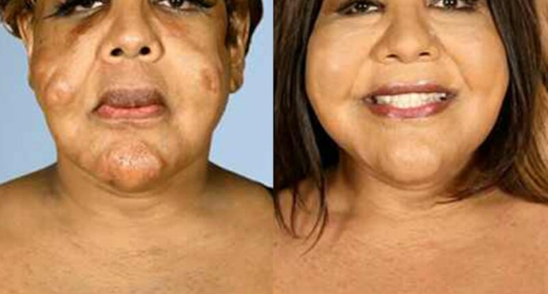 These Botched Plastic Surgery Before-and-After Pics Will Shock You