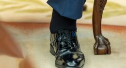 Trump's swollen ankle