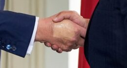 Trump undergoes medical exam for swelling in legs, hand bruising