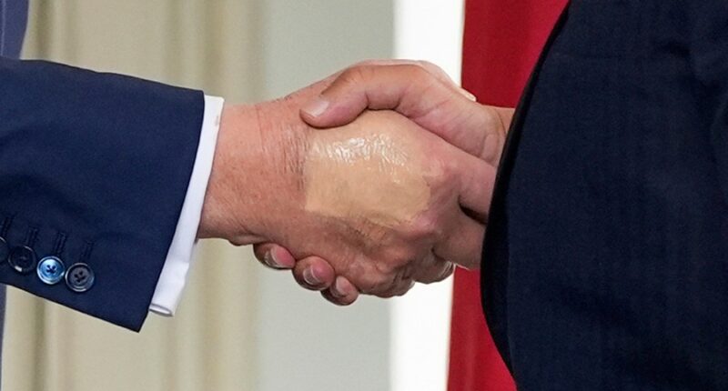 Trump undergoes medical exam for swelling in legs, hand bruising