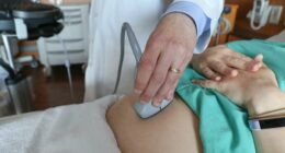 What we know about a new health data tracking system being announced by White House