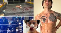 American tourist stabbed while defending women on German tram slams Europe's 'immigration problem' after one of the suspects is freed