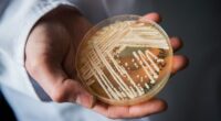 Candida auris cases nearly triple as deadly fungus spreads to new states