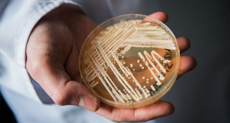 Candida auris cases nearly triple as deadly fungus spreads to new states