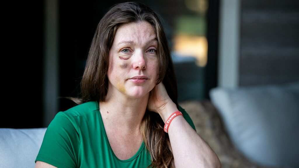 Cincinnati woman speaks out after being beaten for helping attack victim