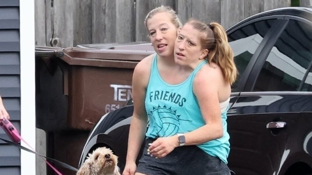 Conjoined twins Abby and Brittany Hensel step out after baby buzz