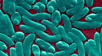 Flesh-eating bacteria: Expert tips for avoiding an infection this summer