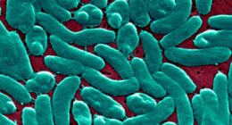 Flesh-eating bacteria: Expert tips for avoiding an infection this summer