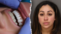 Florida woman arrested for unlicensed dental work allegedly used superglue on victims' teeth: police