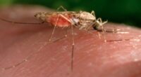 Malaria case in New Jersey resident who hasn't traveled under investigation