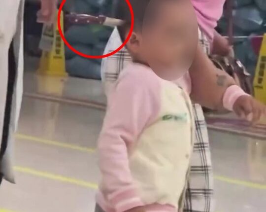 Toddler with knife in head arriving at hospital.