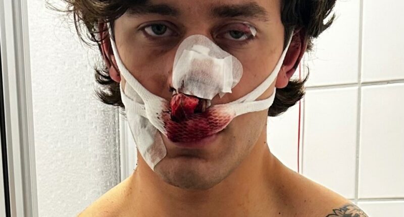 Man with severe facial injuries and blood-soaked bandages.