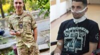 Ukrainian soldier had throat cut by Russian torturers, crawled to safety for 5 days