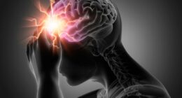 Warning over post-exercise activity: 'It could trigger a stroke'