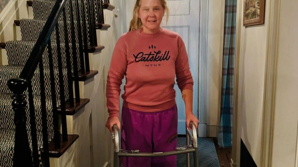 Amy Schumer stuns fans as she uses a walker after surfing accident and secret spinal surgery