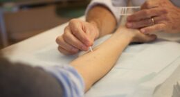 An arm stretched out on an examining table gets pricked with a white needle by the hands of a clinician administering an allergy test.