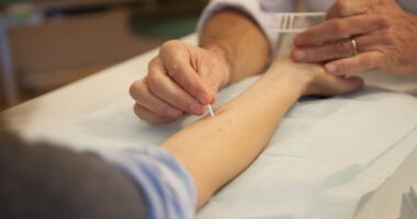 An arm stretched out on an examining table gets pricked with a white needle by the hands of a clinician administering an allergy test.