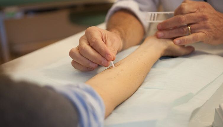 An arm stretched out on an examining table gets pricked with a white needle by the hands of a clinician administering an allergy test.